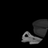SPORK, NICO - 22.03.1976 - 02.08.2022 - CT obere Extremität - 17:51:17